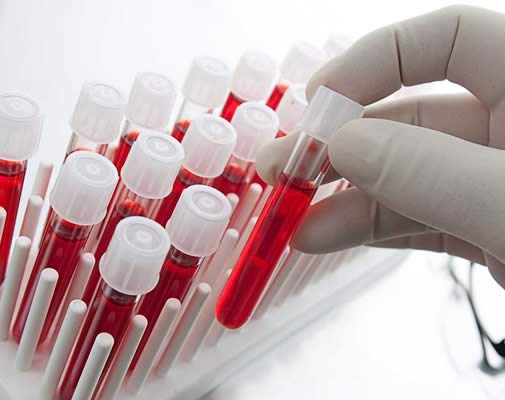 blood biopsy2