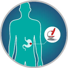 Insufficient Information Obtained by: Traditional Biopsy